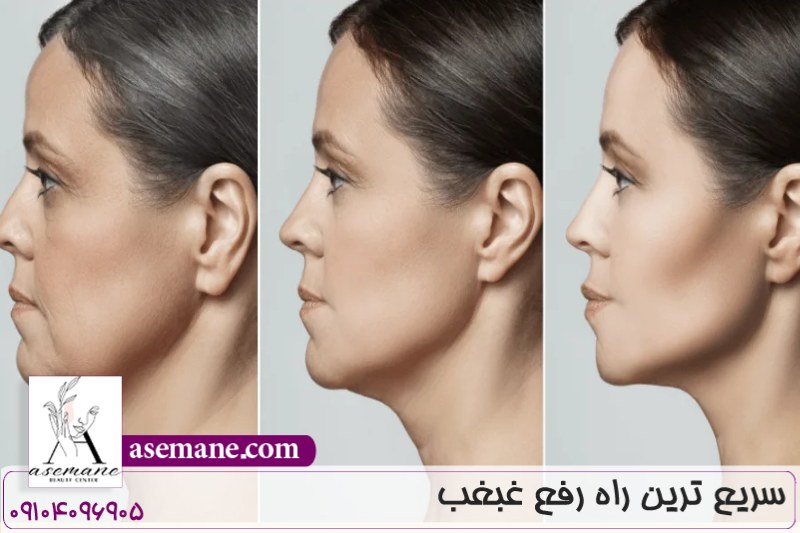 سریع ترین راه رفع غبغب 